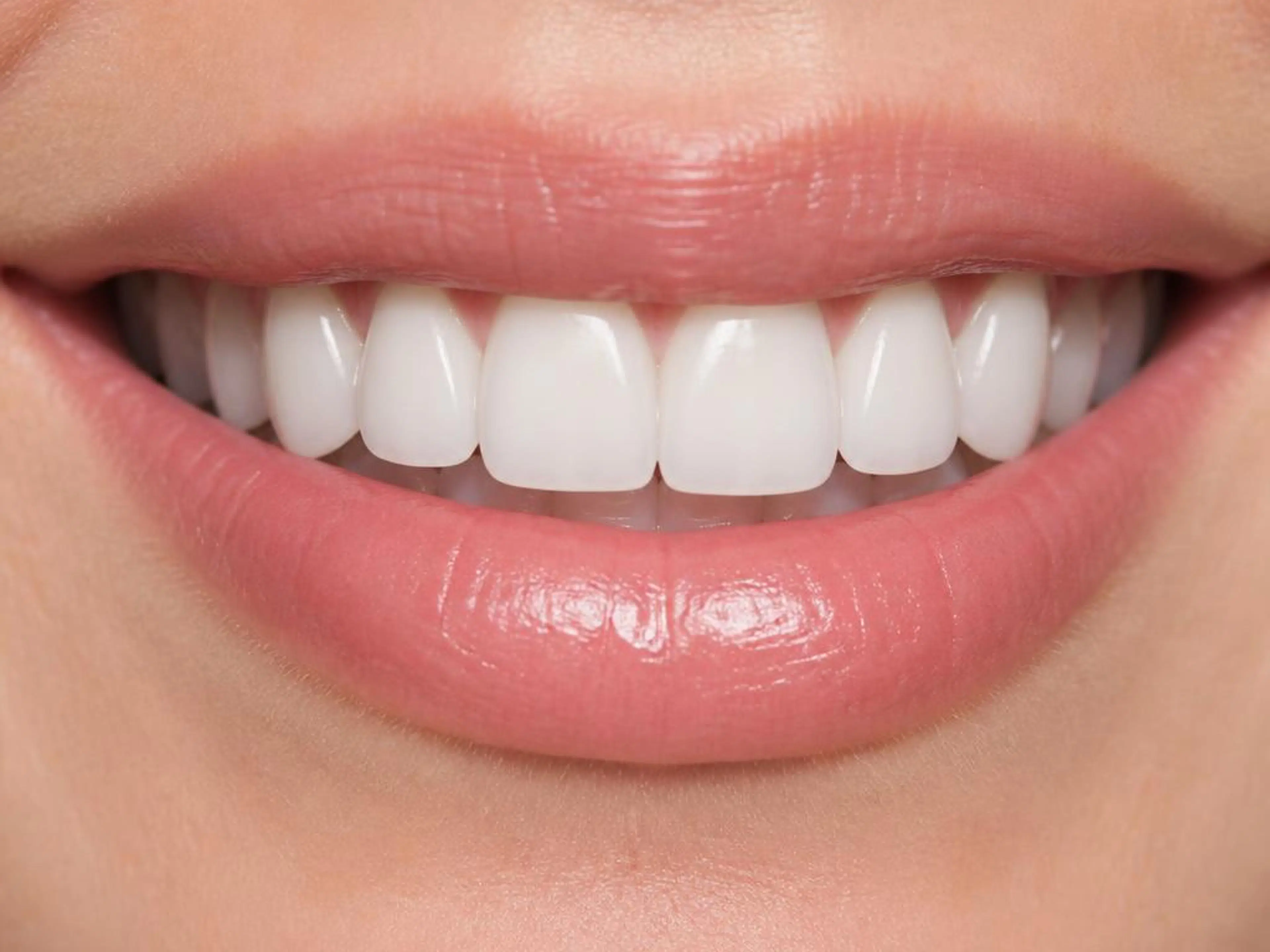Smile Designing